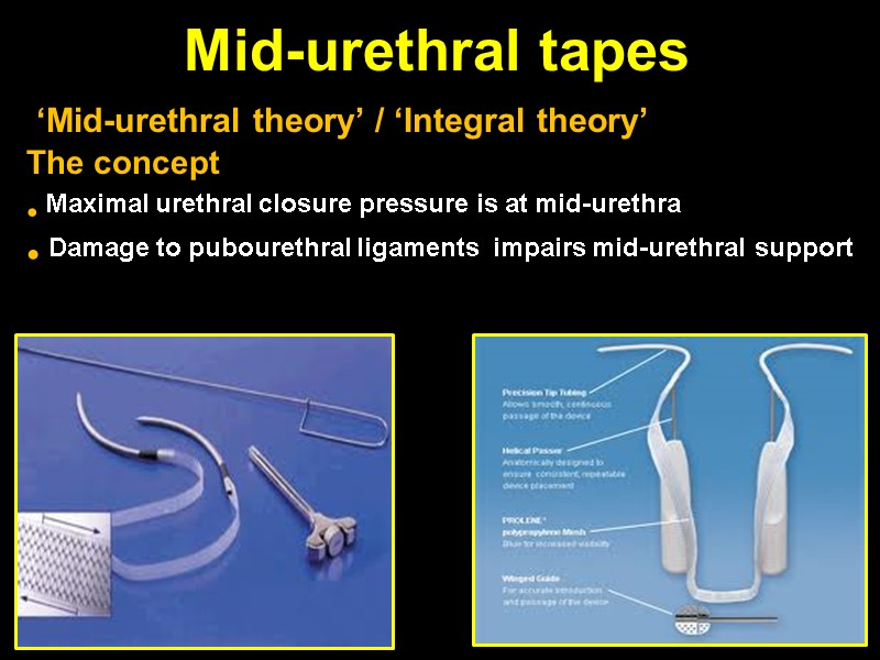 Mid-urethral tapes   ‘Mid-urethral theory’ / ‘Integral theory’  The concept  